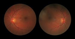 Optics