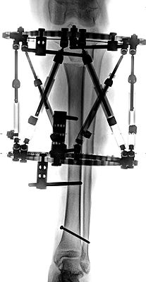 Hexapod.jpg