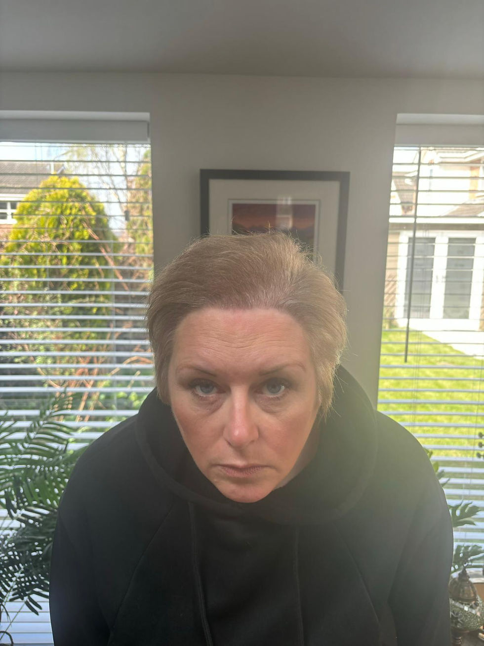 “Hair loss wasn’t just cosmetic — it was emotional. Vita gave me back more than I ever expected.”