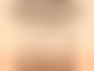 DHI Hair Transplant in Turkey
