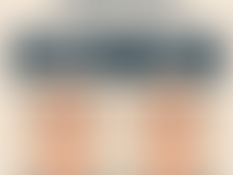 Understanding the Shock Loss Period After a Hair Transplant