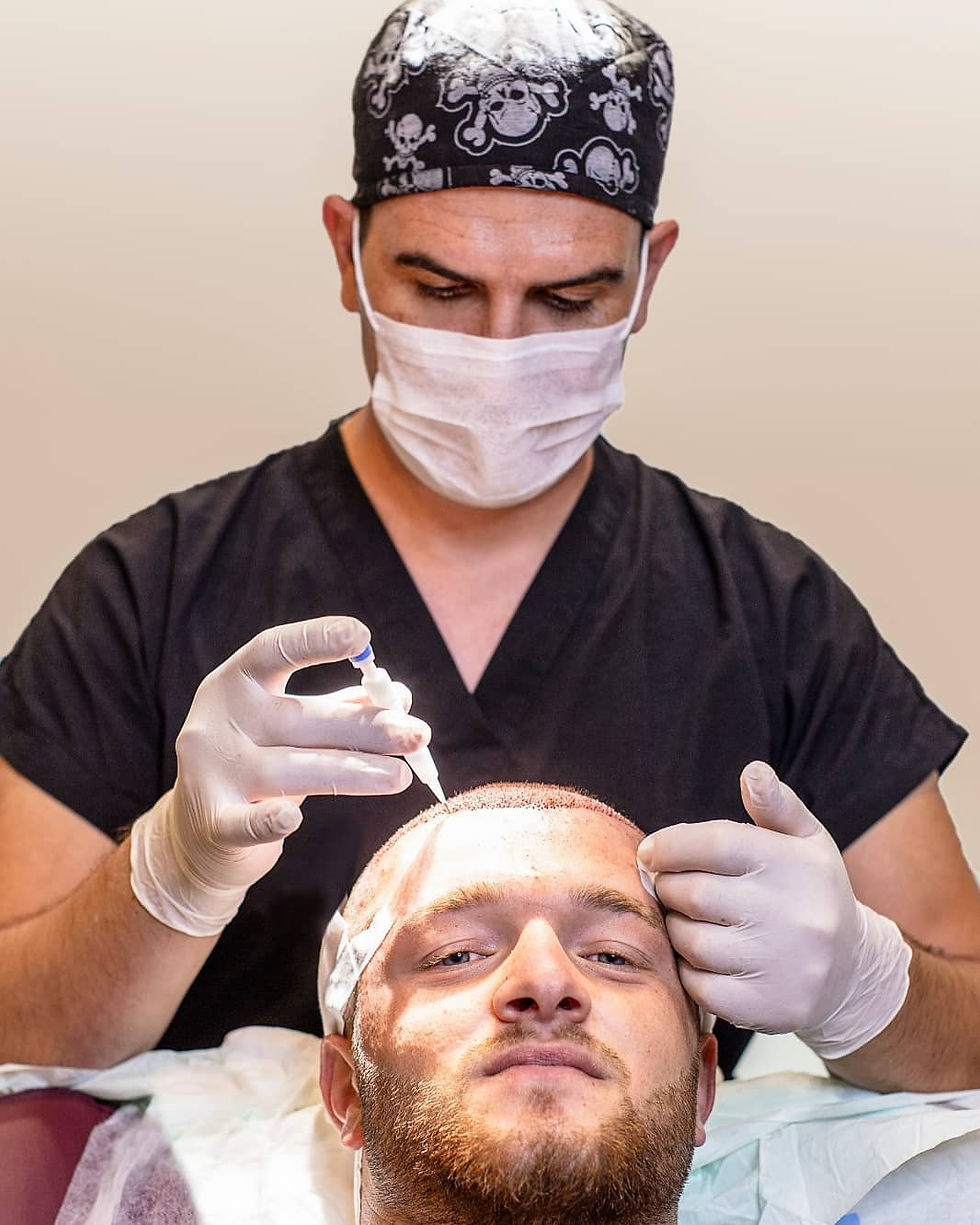 Dr Kinyas Dusunmez DHI Hair Transplant