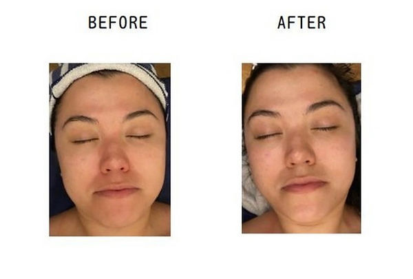 Before and After