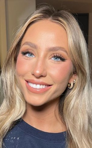 alix earle skin tone with platinum blonde hair