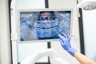 歯のレントゲンを見ながら説明