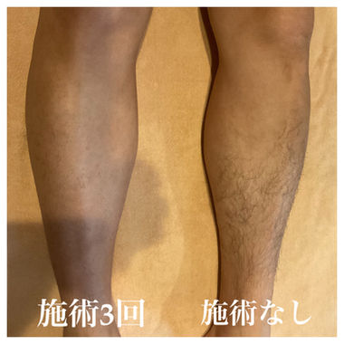 ​成果写真