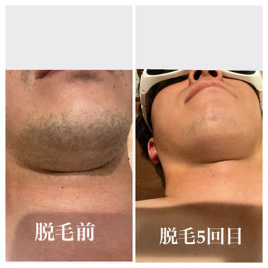 ​成果写真