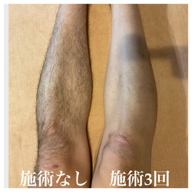 ​成果写真
