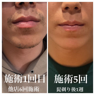 ​成果写真
