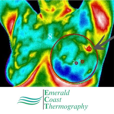 Emerald Coast Thermography