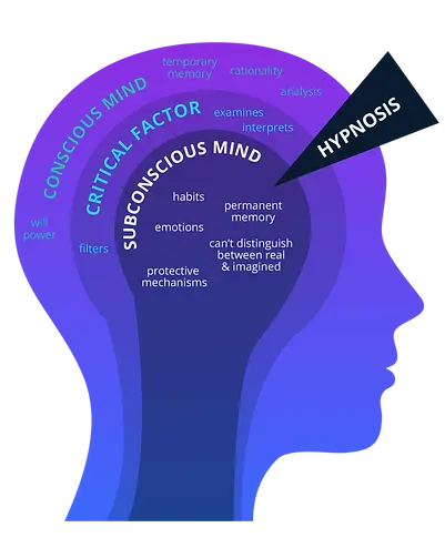 Hypnotheraphy_infographic.webp