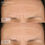 Thumbnail: Dermal Repair Cream