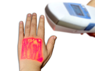 infrared vein finder device finding veins on hand