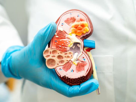 Top Questions to Ask Your Doctor About Kidney Stones