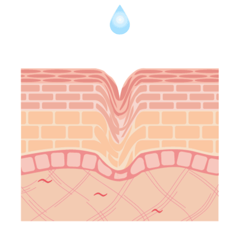 skin.gif