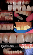 On-Demand Composite Course by Dr. Amanda Seay