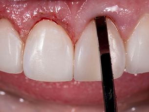 Dr. Amanda Seay’s Guide to Minimally Invasive Smile Transformations