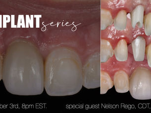 Implant Series! This patient presented with an implant crown showing discolored ceramics and uneven tissue heights.