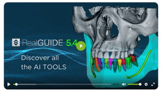 Dental Technology: RealGUIDE 5.0 from 3DIEMME