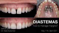 Mid-Treatment MARPE, a Bolton Discrepancy, and the Prepless Hybrid That Saved a Virgin Tooth