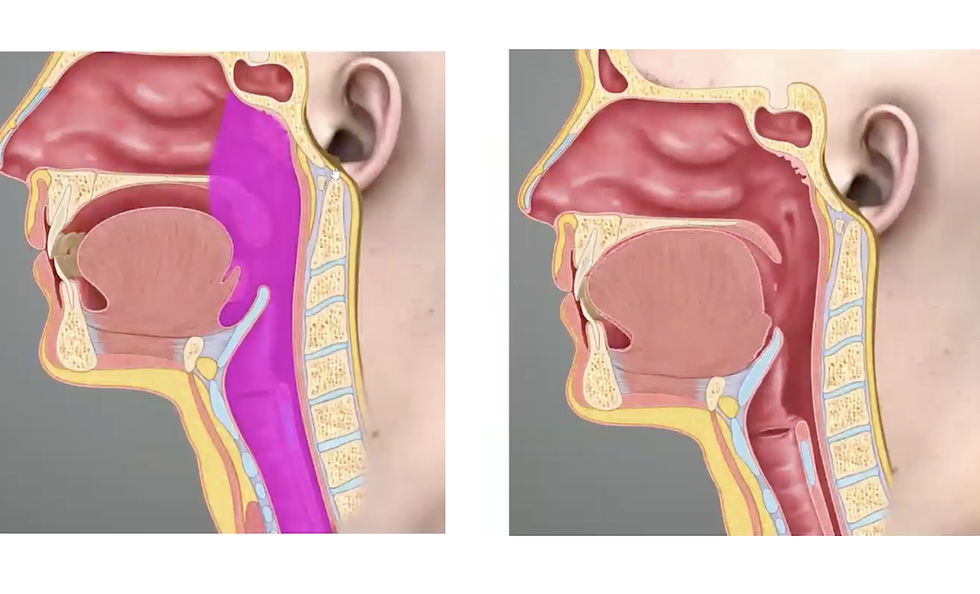 The Dentist’s Role in Pediatric Sleep-Disordered Breathing