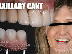 Case Discussion: Managing an Extreme Skeletal Cant With Limited Treatment Options