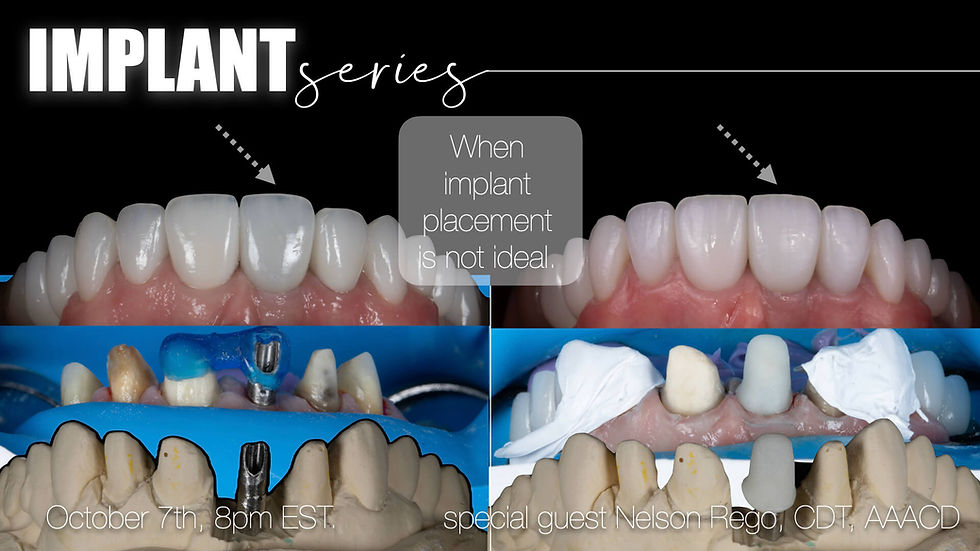 Mastering Esthetics in Challenging Implant Cases
