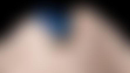 Single-Tooth Case Breakdown: Where Emergence Meets Esthetics 