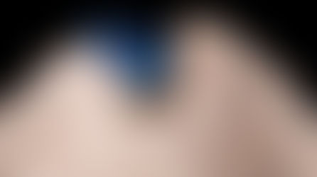 Single-Tooth Case Breakdown: Where Emergence Meets Esthetics 