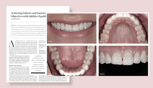 Achieving Esthetic and Functional Objectives with Additive Equilibration