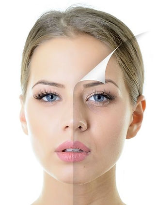 Skin_Peel.jpeg