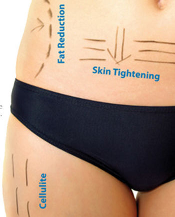 Fat reduction treatment