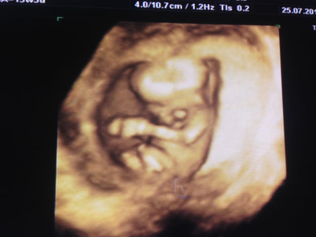 13 semanas