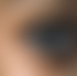 NÃO QUERIA ENXERGAR UM MUNDO SEM "AUGUSTUS"