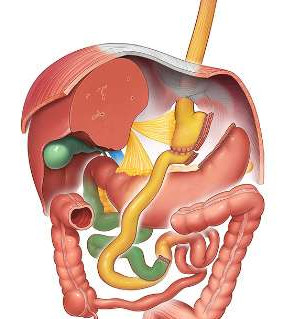 Roux-en-Y gastric bypass / RnYGB