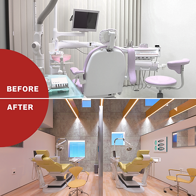 before-after.png