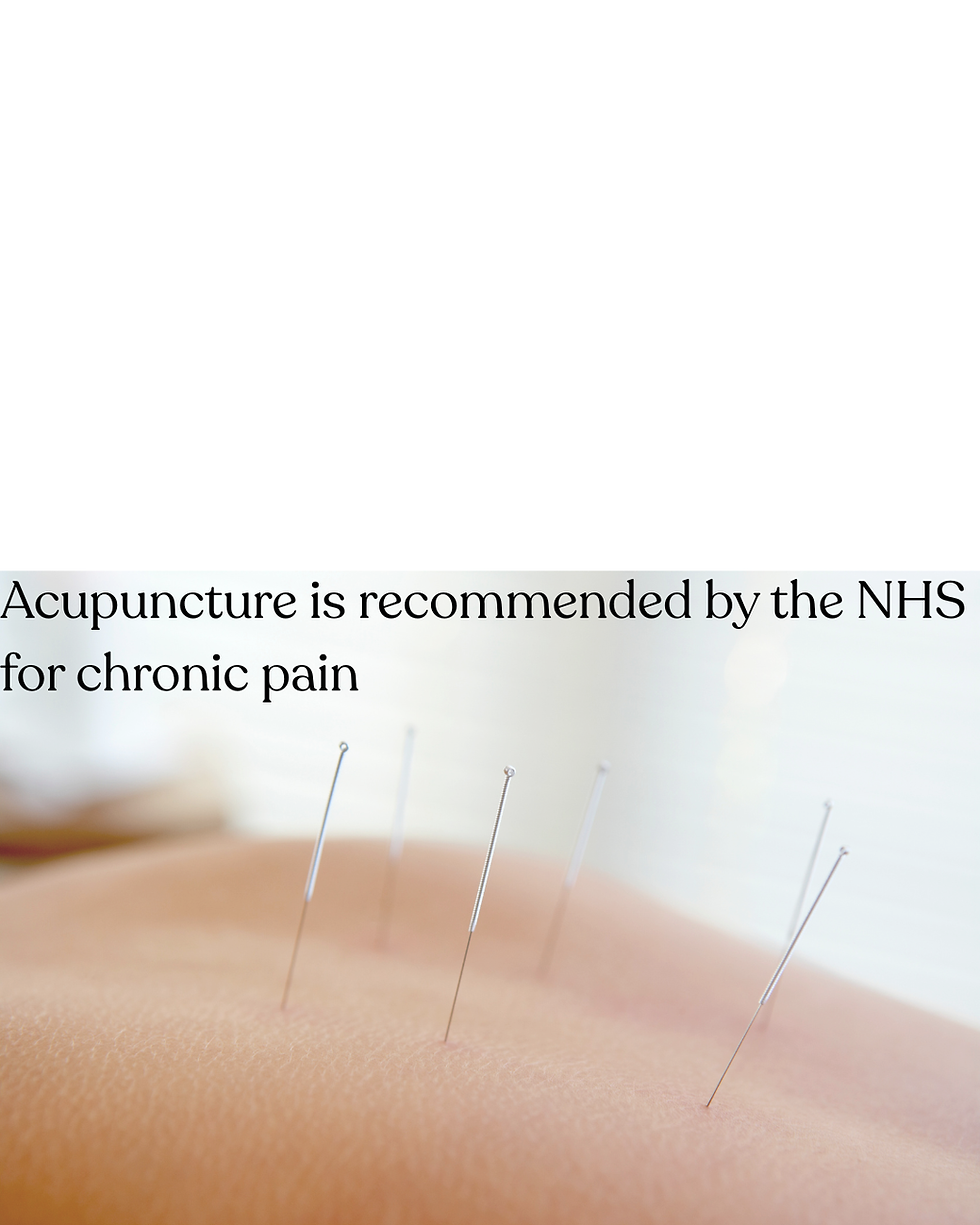 Acupuncture can be used to help manage chronic pain