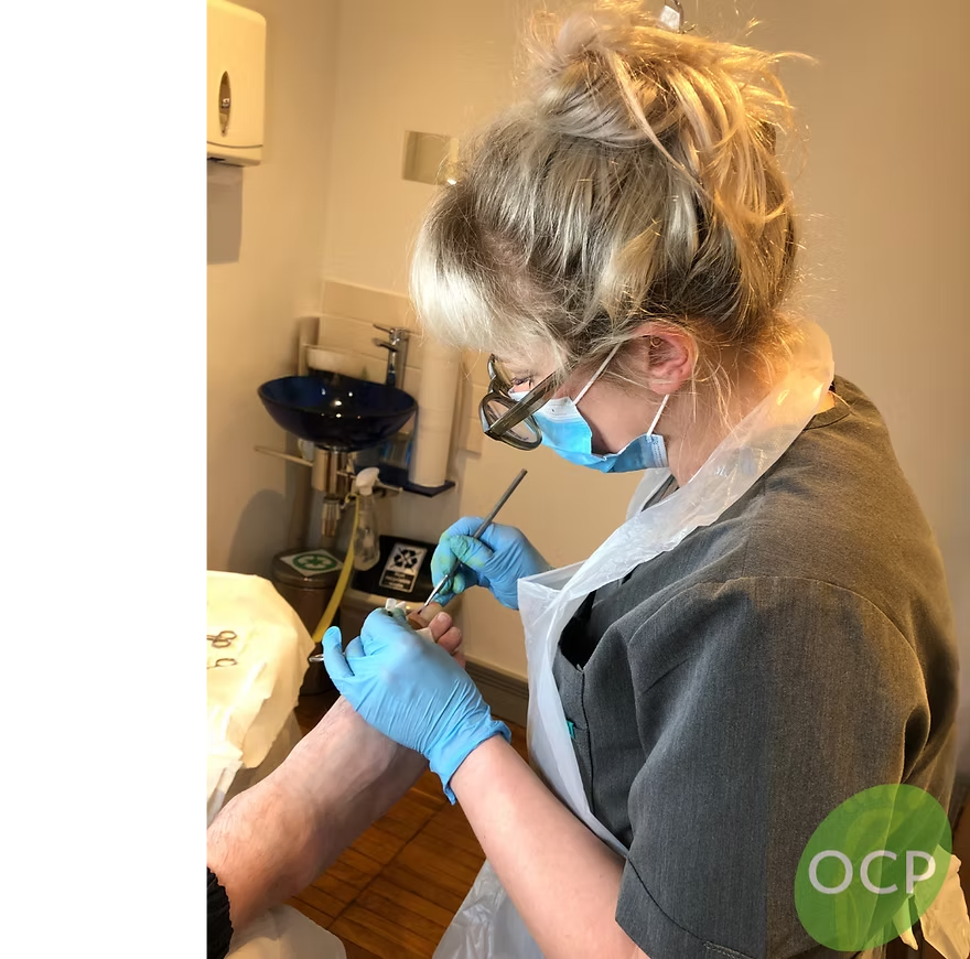 Felicity performing a toenail procedure