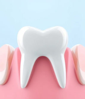 self-adhering dental composite - Vertise Flow Composite.jpg