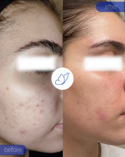 D1 - Chrysalis B&As (1)