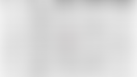 Supraventriküler Taşikardi (SVT)