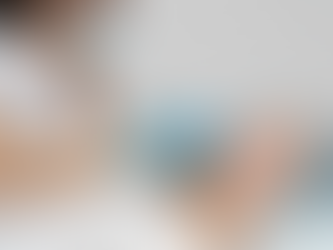 Top 5 Things To Know Before Getting a Non-Surgical Thread Lift