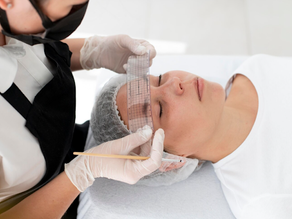 PDO Threads vs. Laser Tightening Near NYC: Which Gives Longer-Lasting Results?