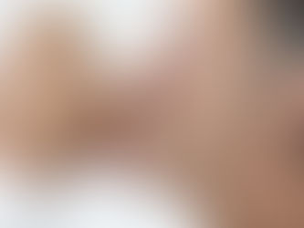 Novembro azul: diabetes e o cuidado com a saúde ocular