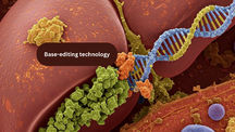 Gene editing with base editor helps infant avoid liver transplant for CPS1