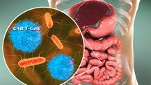 Microbiome’s impact on CAR T-cell therapy efficacy and toxicity in cancer treatment