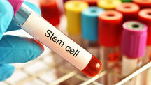 Regenerating Hearts: How Stem Cell Therapy Could Transform the Treatment of Congenital Heart Diseases