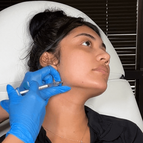 dermal-filler.gif