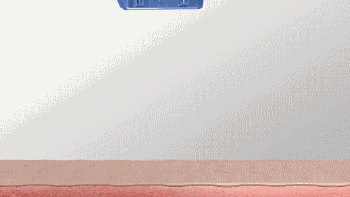 Trans Epidermal Delivery