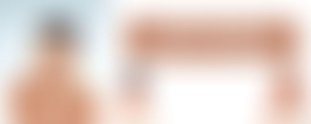       DARK CIRCLES = CURE IN AYURVEDA